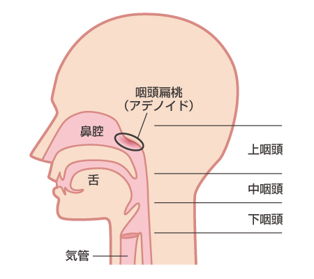 咽頭炎