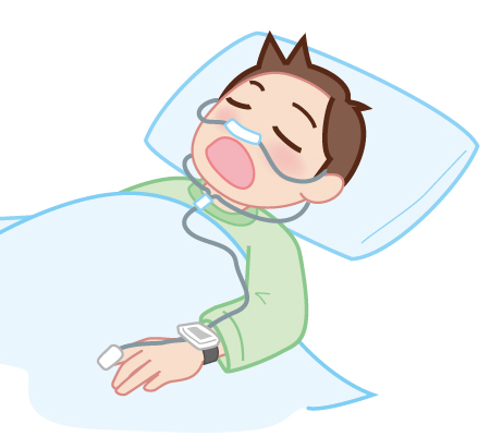 小児の睡眠時無呼吸症候群の検査と診断