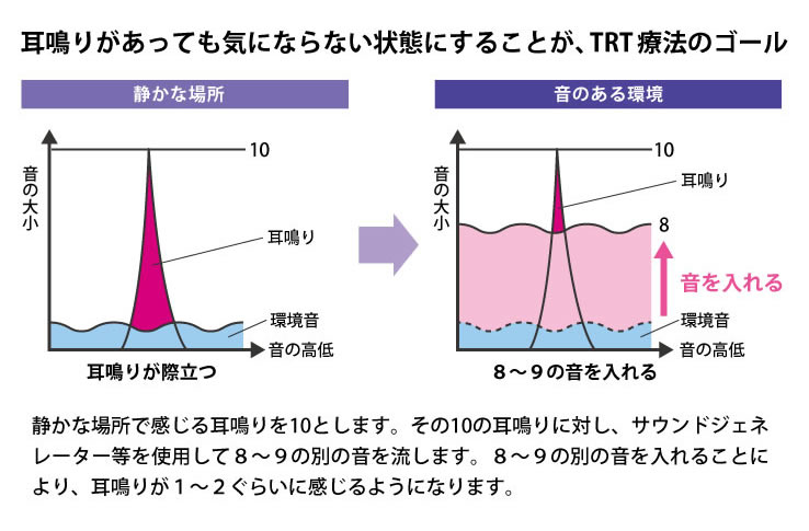 耳鳴り再訓練療法はどのように機能しますか?